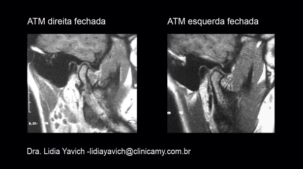 10 RESSONANCIA DIR E ESQU