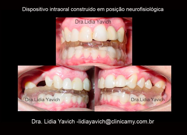 12 A DENTES-1ORTOSE