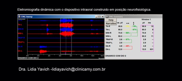 12 B ELECTRO com DIO 1 CORT