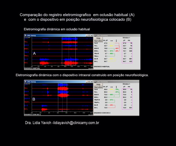 13 B electros comparativas