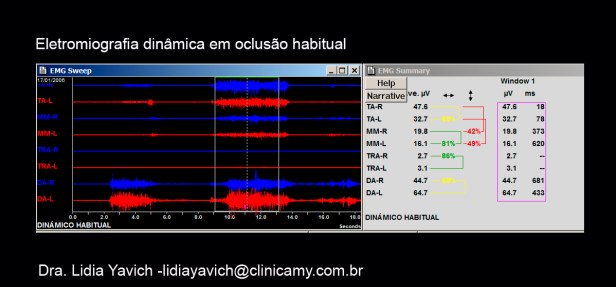4 B ELECTRO HABITUAL 1 CORTADA