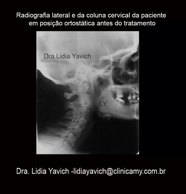 8 CERVICAL INICIAL CRISTIANE KELLY