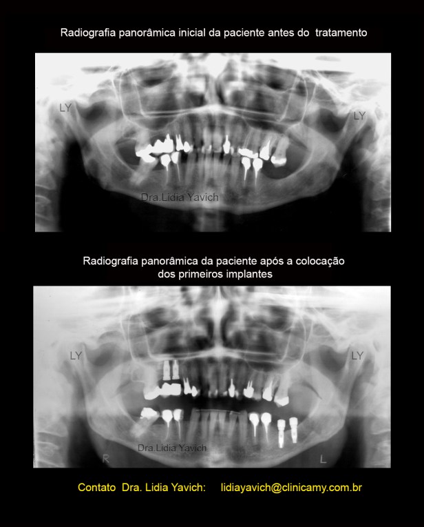 10C panoramicas comparativas