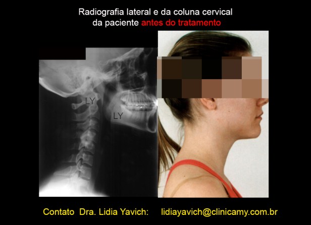 12 cervical
