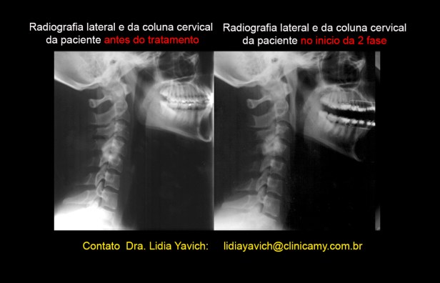 17 comparativas coluna 1