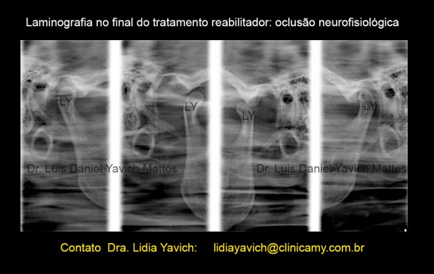 17 laminografia final