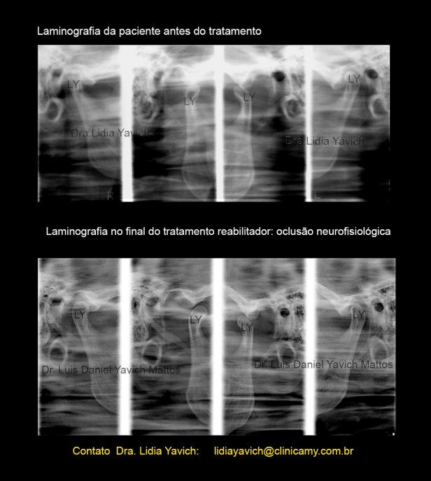 18 laminografias comparativas
