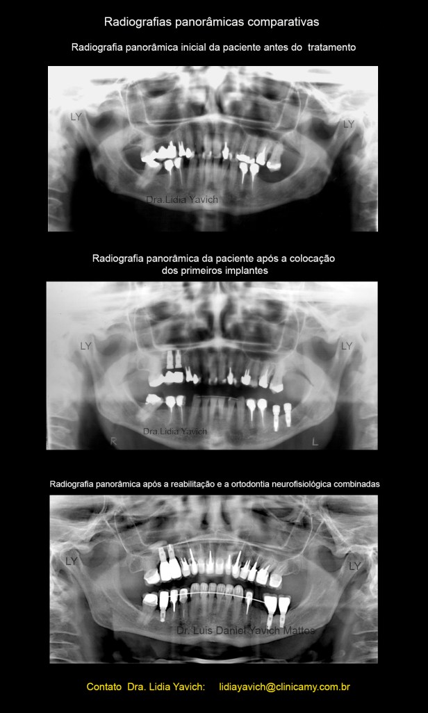 20 panoramicas comparativas