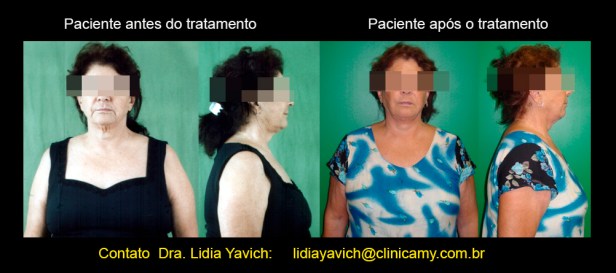 22 postura comparativa