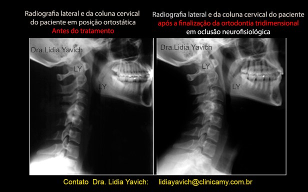 32 final CERVICO COMPARATIVAS
