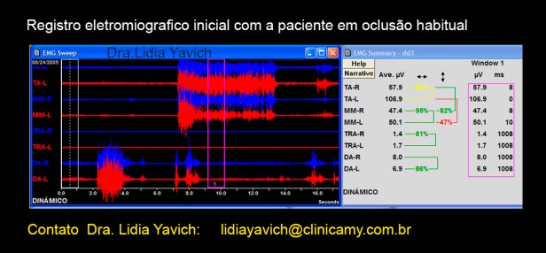 3b dinamico habitual