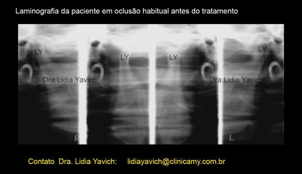 5LAMINOGRAFIA INICIAL