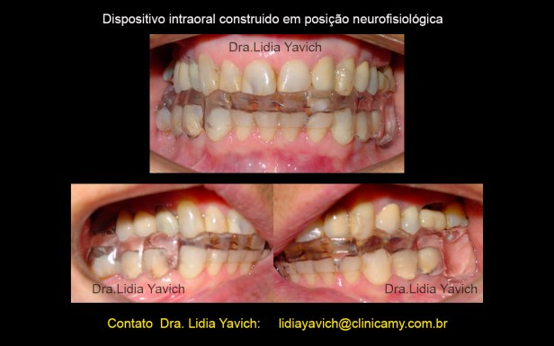 8 A DENTES ORTOSE