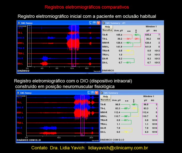 19 eletro comparativas