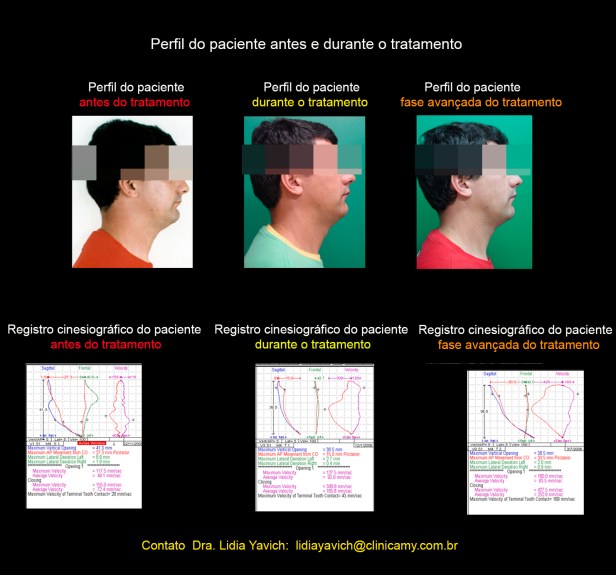 21 cinecio comparativas e fotos