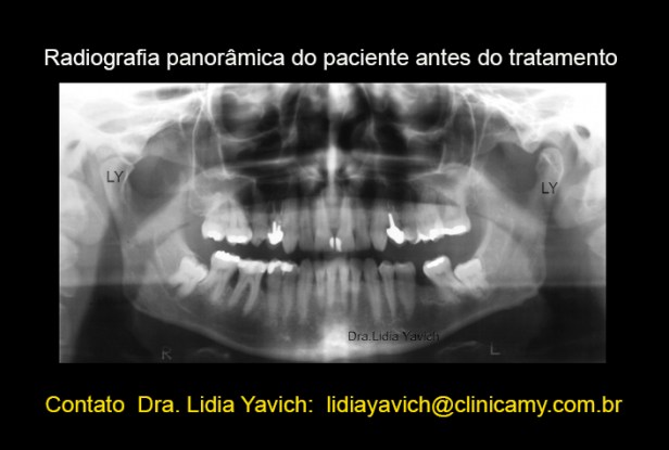 5 PANORAMICAS ERALDO