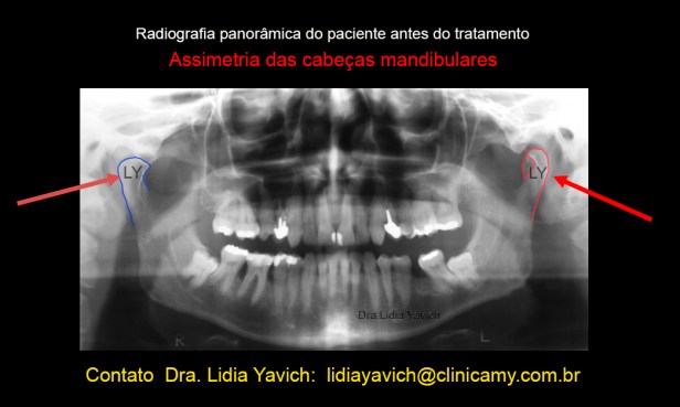 6 PANORAMICAS ERALDO