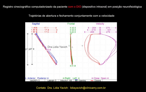 12 ABRE FECHA ORTESE