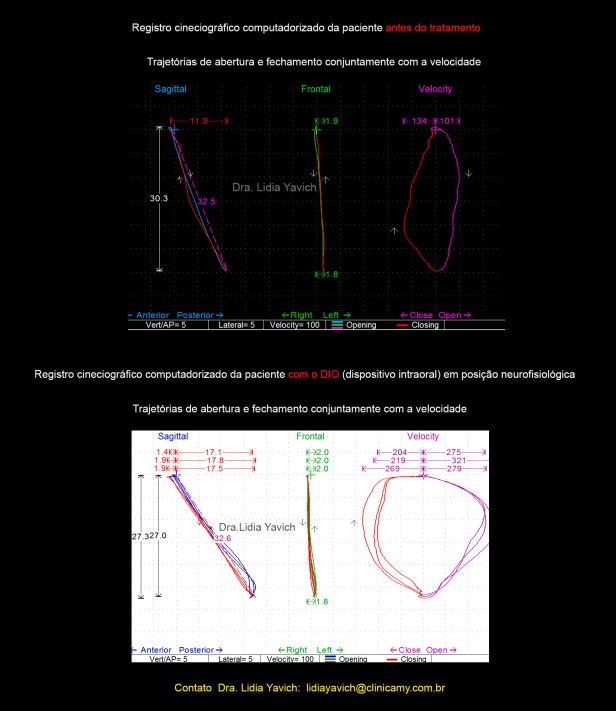 13 ABRE FECHA comparativas