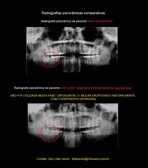 15 PANORAMICAS COMPARATIVAS