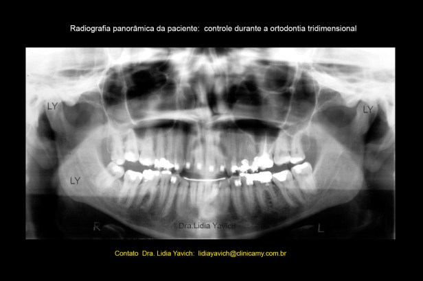 18 PANORAMICA CONTROLE ORTO