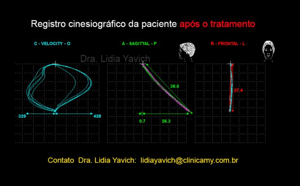 23 ABRE FECHA APOS O TRATAMENTO 2