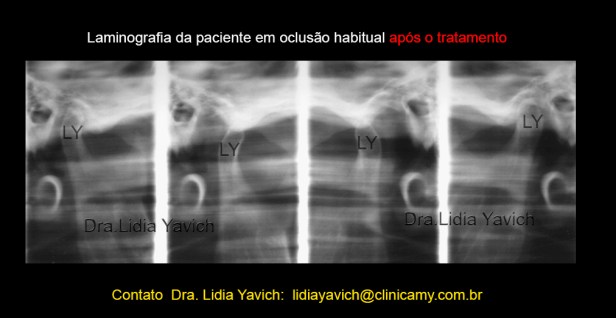 24 LAMINOGRAFIAfinal L