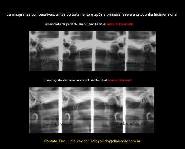 25 LAMINOGRAFIAS COMPARATIVAS