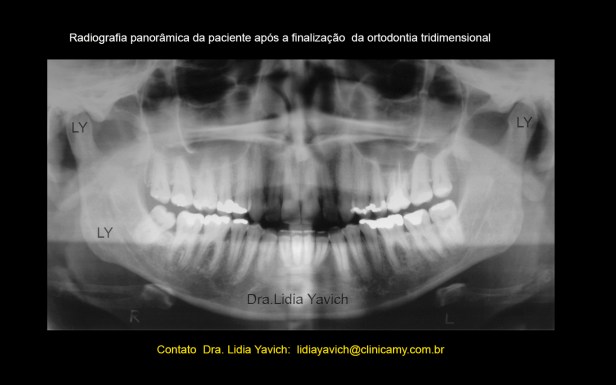 26 panoramica final L