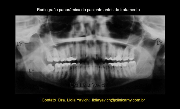 4A PANORAMICA INICIAL