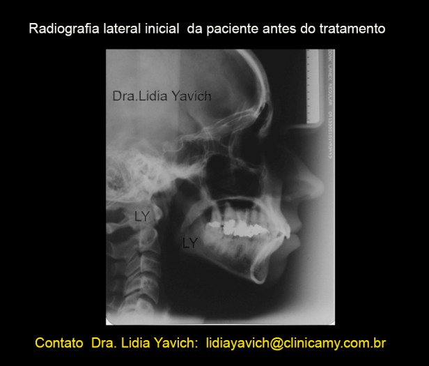 4C RADIOGRAFIA LATERAL INICIAL