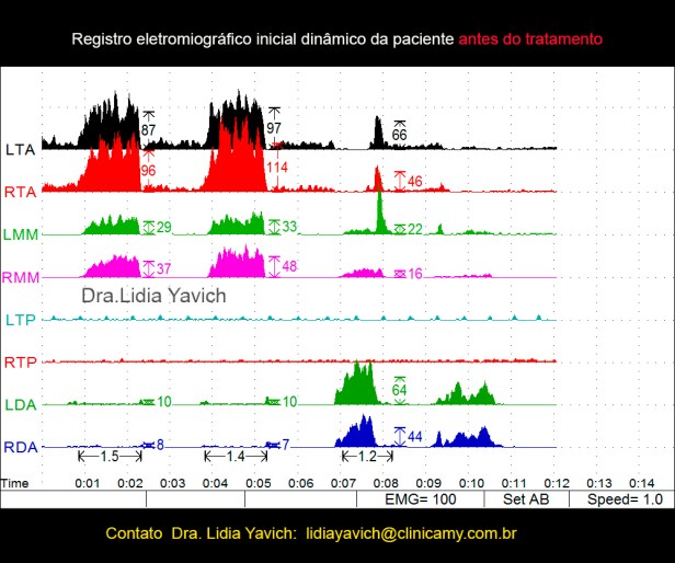 7 MORDE FORTE ABRE ENGOLE