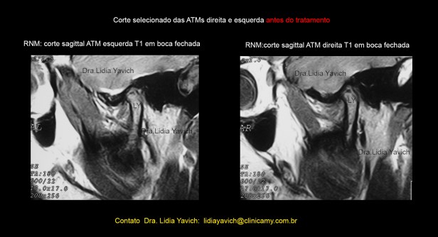 9 ressonancias iniciais