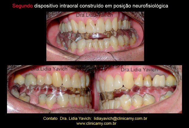 10  0clusão com o 2 DIO