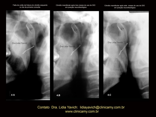 11 comparação de panorâmicas