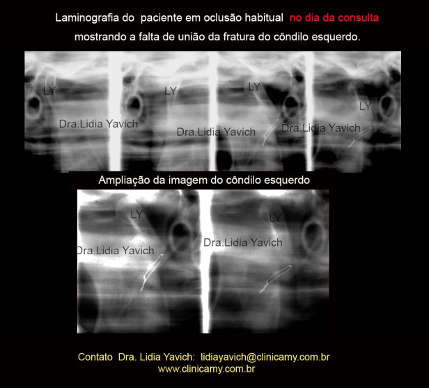 3 LAMINOGRAFIA INICIAL