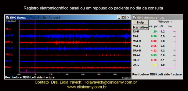 7 A ELETROMIOGRAFIA INICIAL
