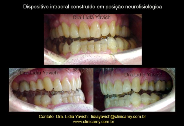 9 0clusão com o DIO