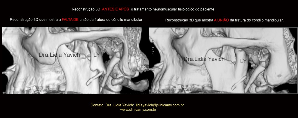 Esta imagem possuí um atributo alt vazio; O nome do arquivo é 15-3d-comparativas.jpg