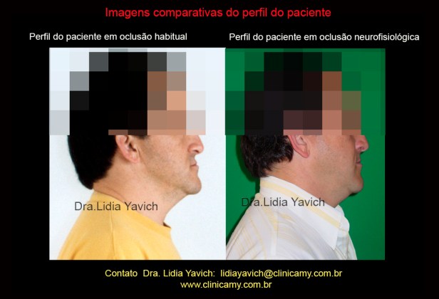 15 PERFIS COMPARATIVOS