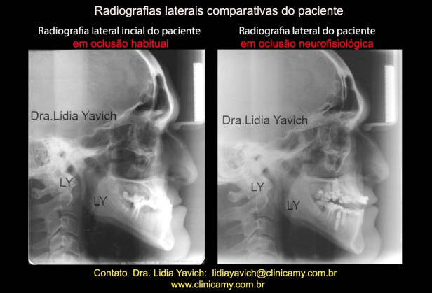 15b RADIOGRAFIAS LATERAIS COMPARATIVAS