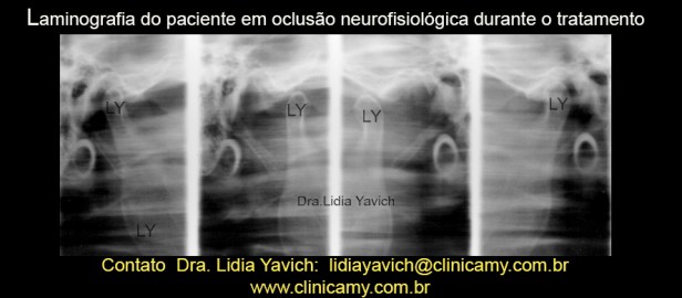 17 LAMINOGRAFIAS CONTROLE