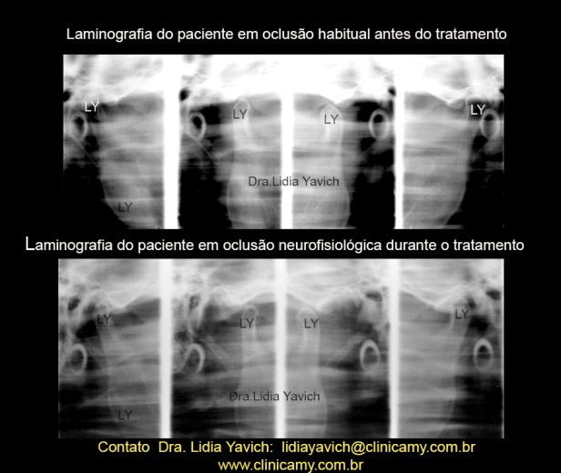 18 LAMINOGRAFIAS COMPARATIVAS