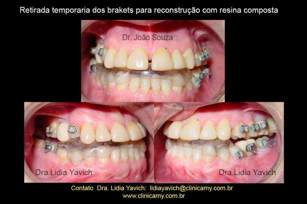 21 REABILITAÇÃO E ORTO E IMPLANTES
