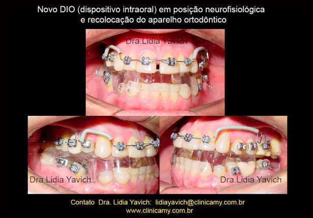 22 ORTESE NOVA REABILITAÇÃO E ORTO E IMPLANTES