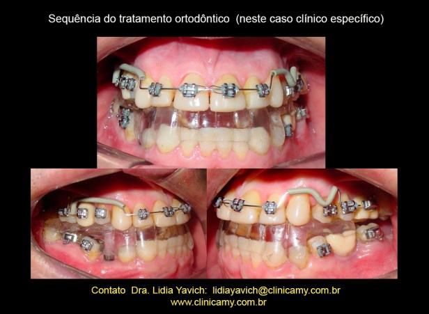 24 ORTESE NOVA REABILITAÇÃO E ORTO E IMPLANTES 2
