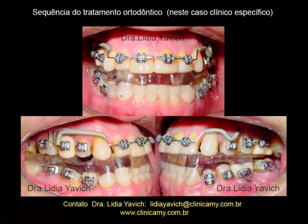25 ORTESE NOVA REABILITAÇÃO E ORTO E IMPLANTES 3