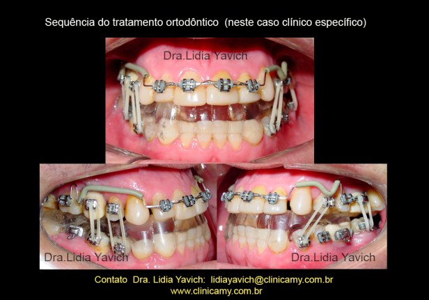 26 ORTESE NOVA REABILITAÇÃO E ORTO E IMPLANTES 4