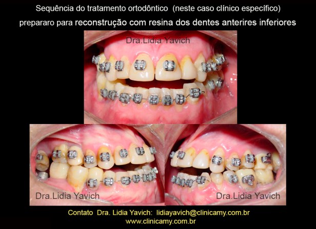 27 ORTESE NOVA REABILITAÇÃO E ORTO E IMPLANTES 5
