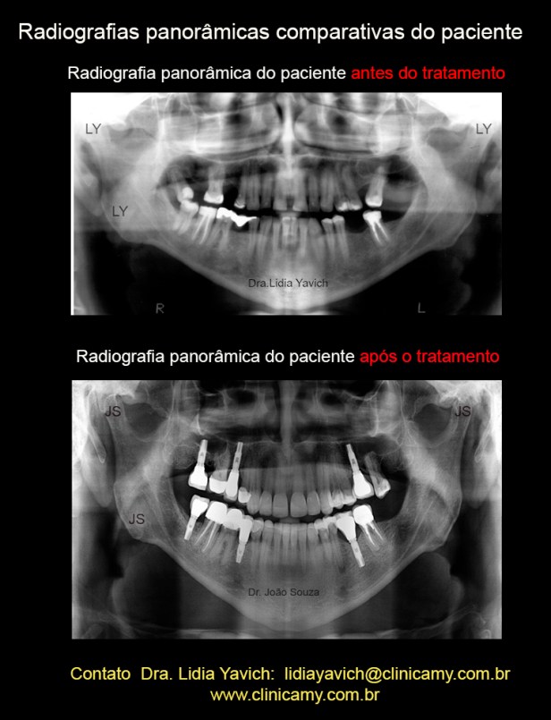 32 panoramicas comparativas